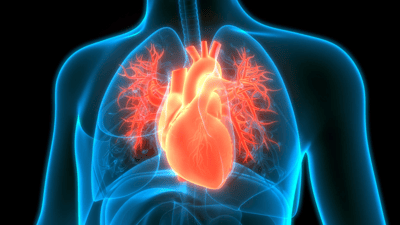 Tumores del corazón: Comprendiendo el Mixoma y Otras Variantes